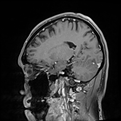 Click on the Serie image to view the images of VILLANUEVA, WILLIAM A.